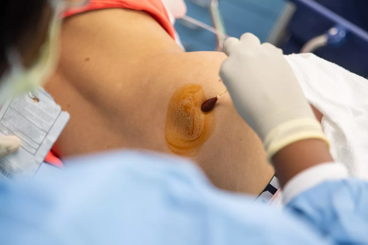Bone Marrow Biopsy & Aspiration in Jalandhar